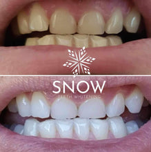 Load image into Gallery viewer, Snow Teeth Whitening™ At-Home System All-in-One Kit