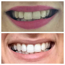 Load image into Gallery viewer, Snow® At-Home Teeth Whitening Kit - 50% Off
